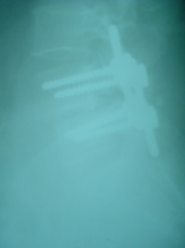 coimbatore-orthopaedic-joint-replacement-maternity-child-welfare-centre-india